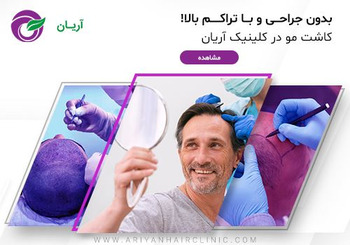 مرکز کاشت مو در شیراز - کلینیک آریان